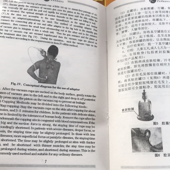 Traditional Chinese 12-Cup Cupping Therapy Massage Set - Picture 7 of 8